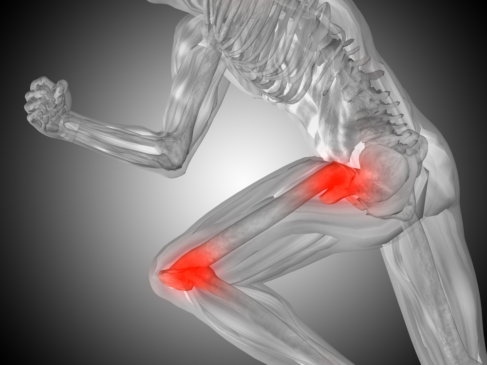 Hip & Knee Pain Bryan, TX